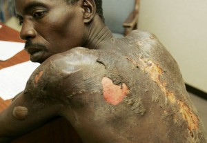 State-sponsored torture was widespread around the 2008 elections.