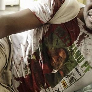 ‘We won’t allow this cowardly act to get in our way,’ says Zim leader after assassination attempt